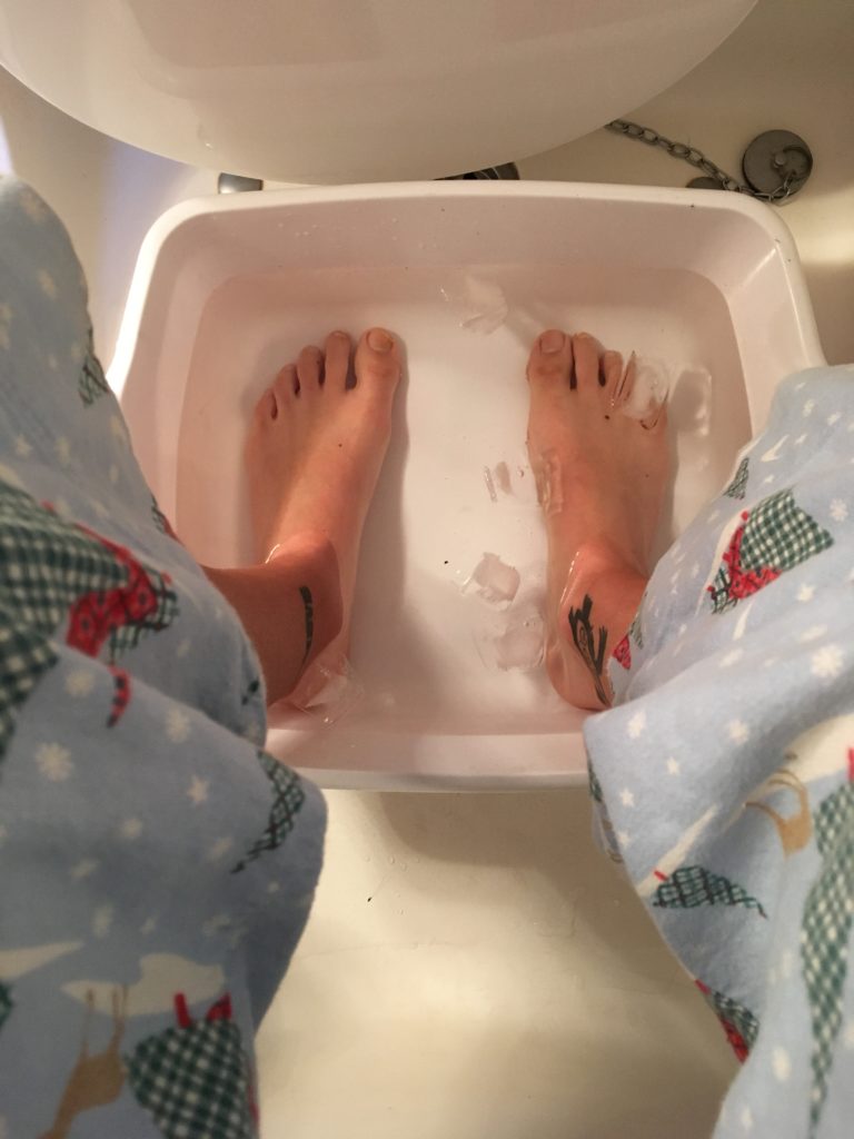 feet in ice bath for transverse arch pain